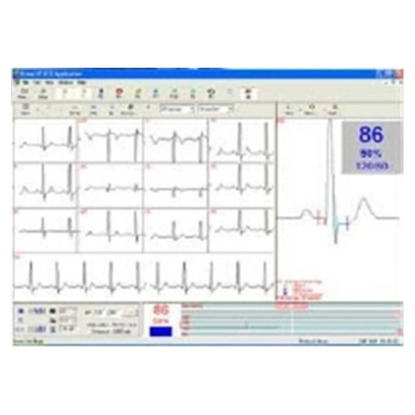 Software Stress Test For Norav 1200 Ea